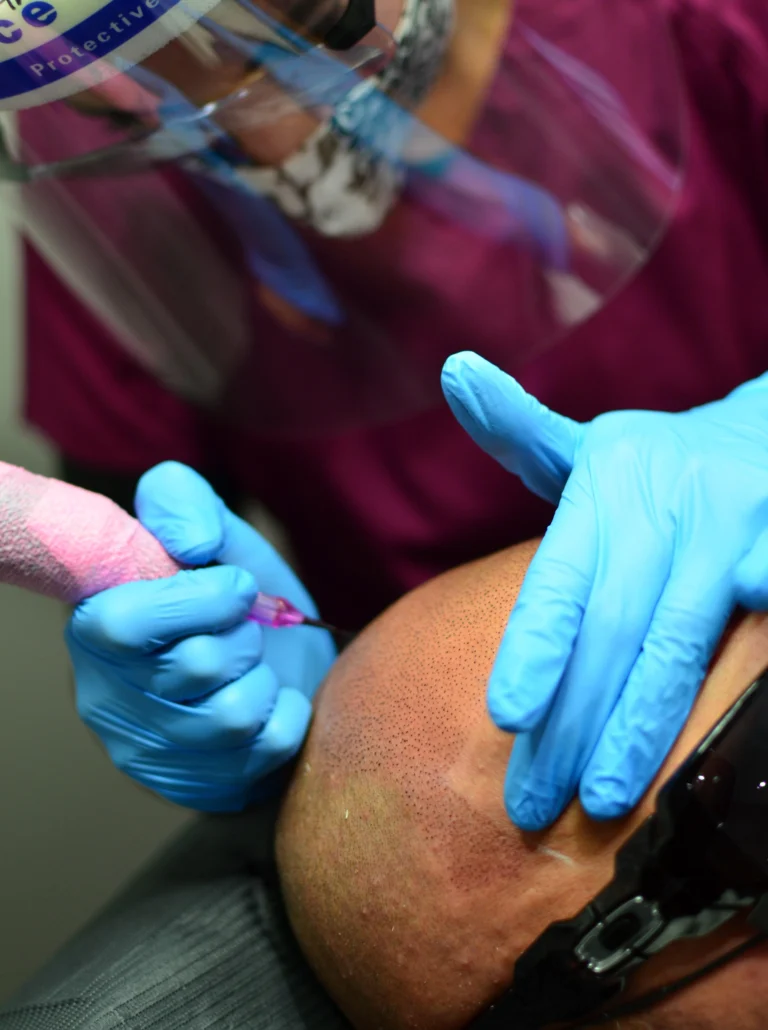 Aftercare in Scalp Micropigmentation